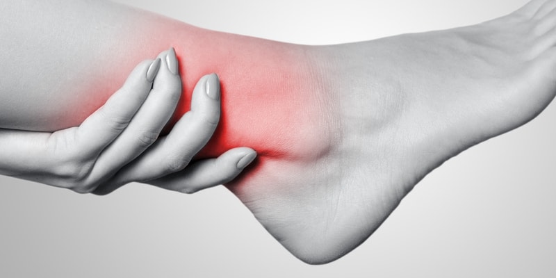 Sprained Ankles