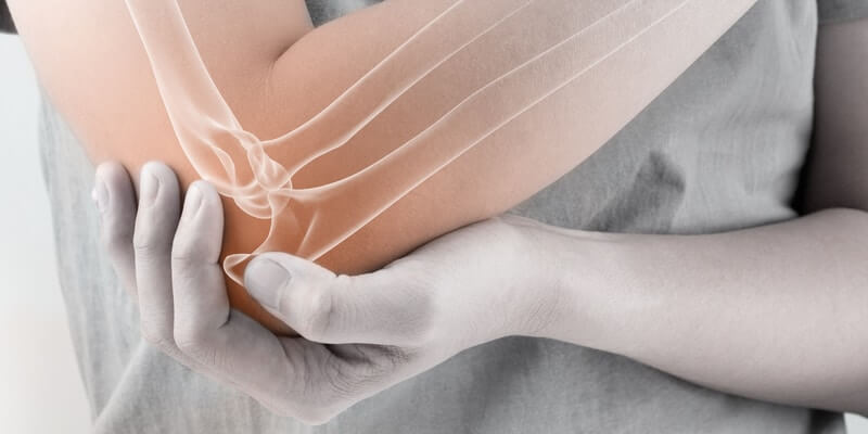 Rheumatoid Arthritis