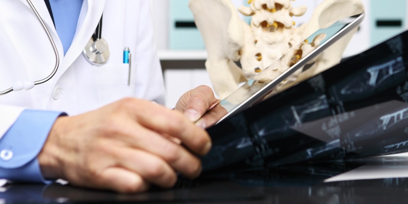 Discectomy