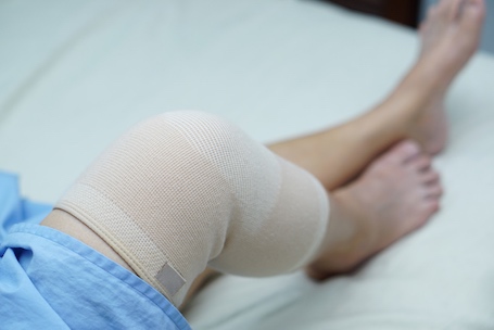 Total Knee Replacement